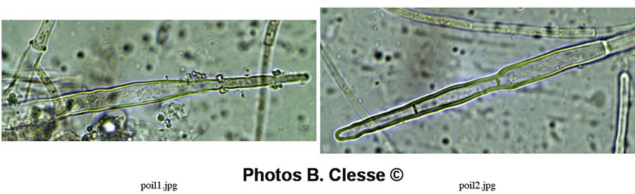 Neottiella hetieri