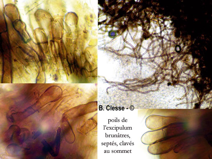 Pseudoplectania nigrella