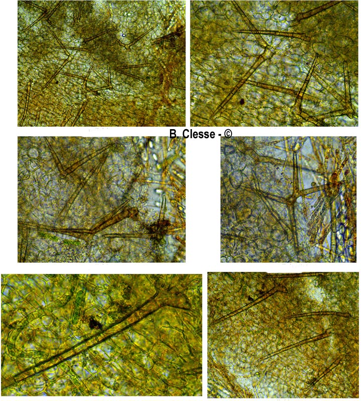 Scutellinia crucipila