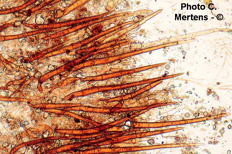  Scutellinia legaliae