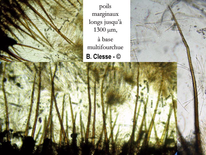 Scutellinia trechispora