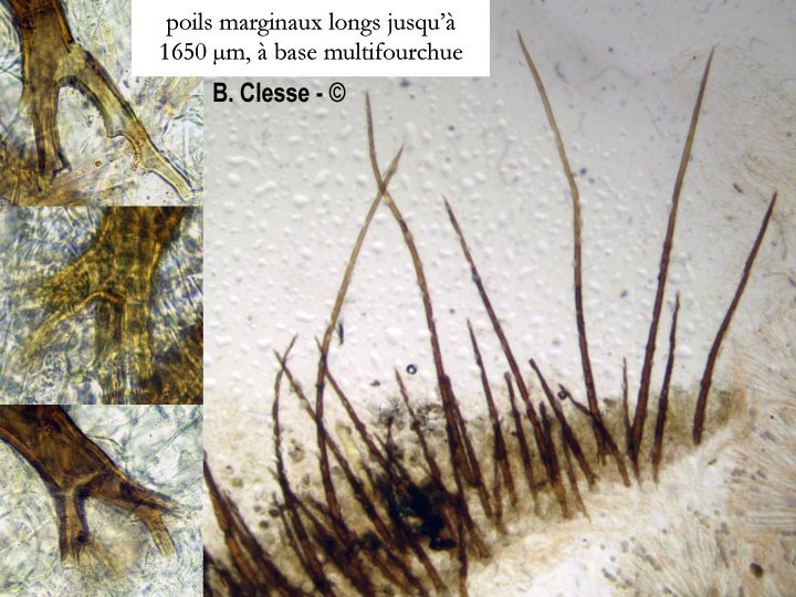Scutellinia trechispora