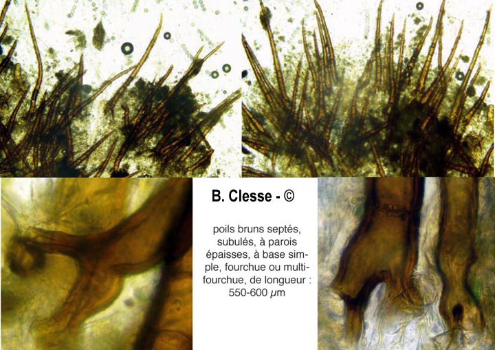 Scutellinia trechispora