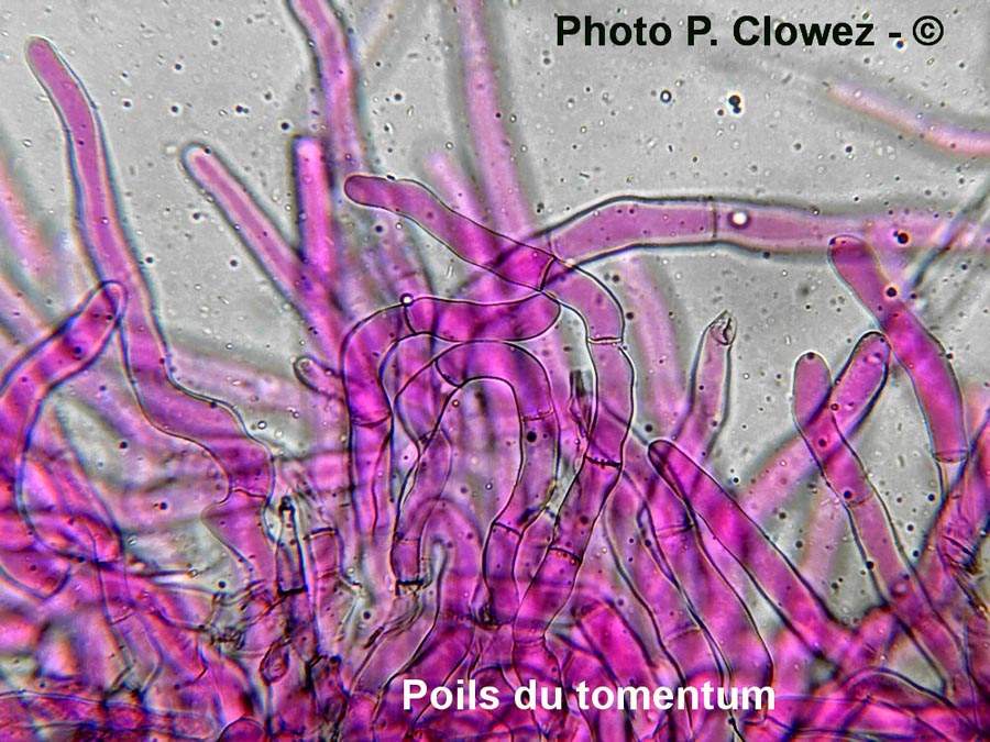 Sowerbyella polaripustulata