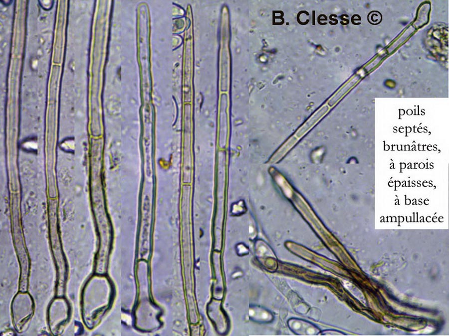 Trichophaea abundans