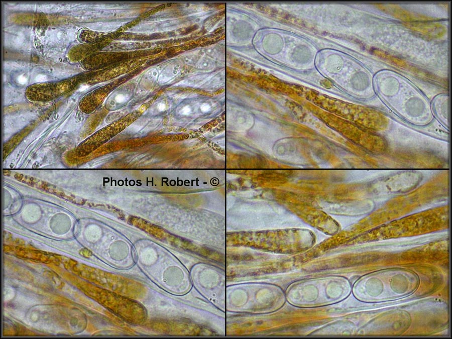 Anthracobia macrocystis