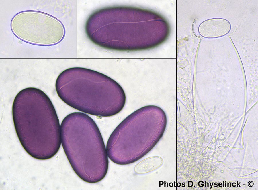 Ascobolus immersus