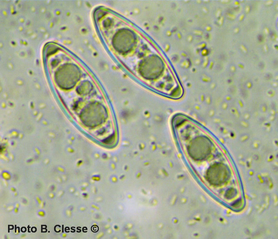 Byssonectria fusispora