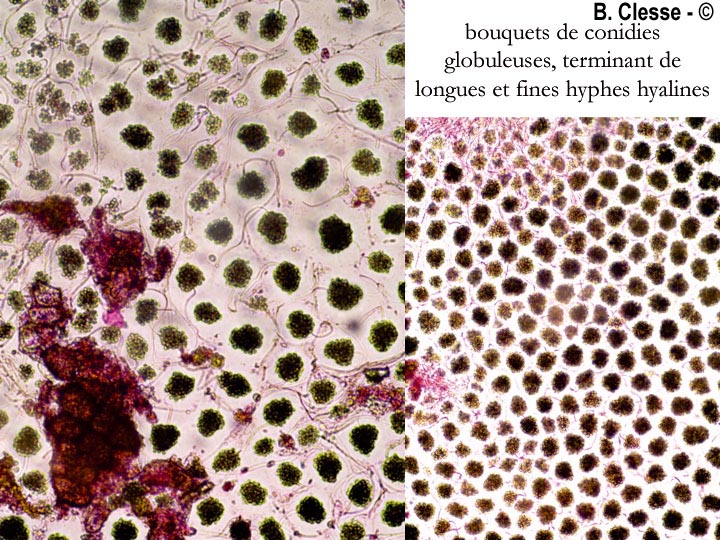 Cheirospora botryospora