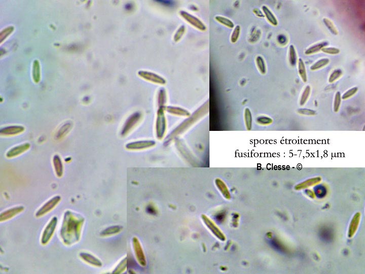 Dasyscyphella montana
