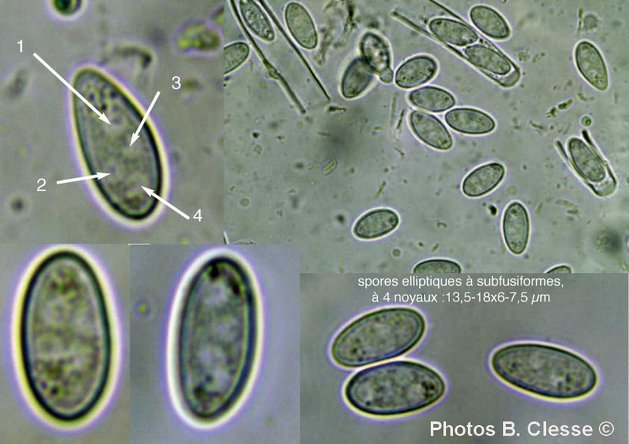 Dumontinia tuberosa