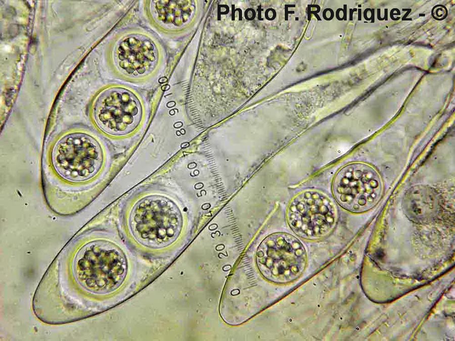 Labyrinthomyces donkii