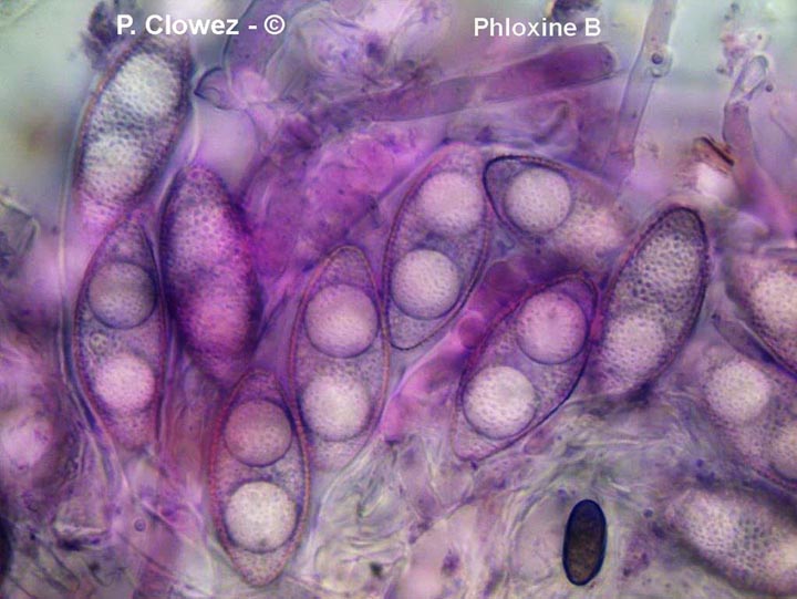 Leucoscypha leucotricha