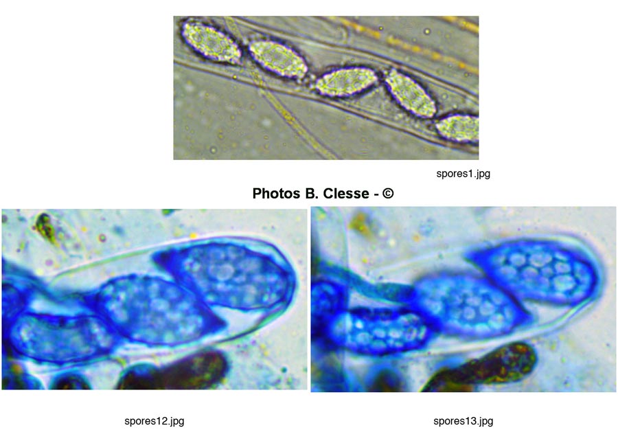 Melastiza cornubiensis