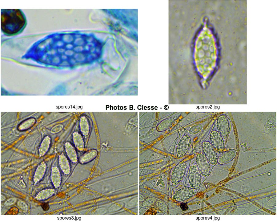 Melastiza cornubiensis