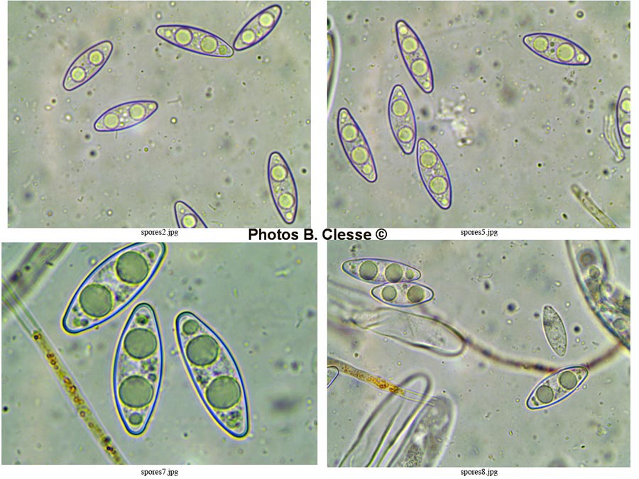 Octospora coccinea