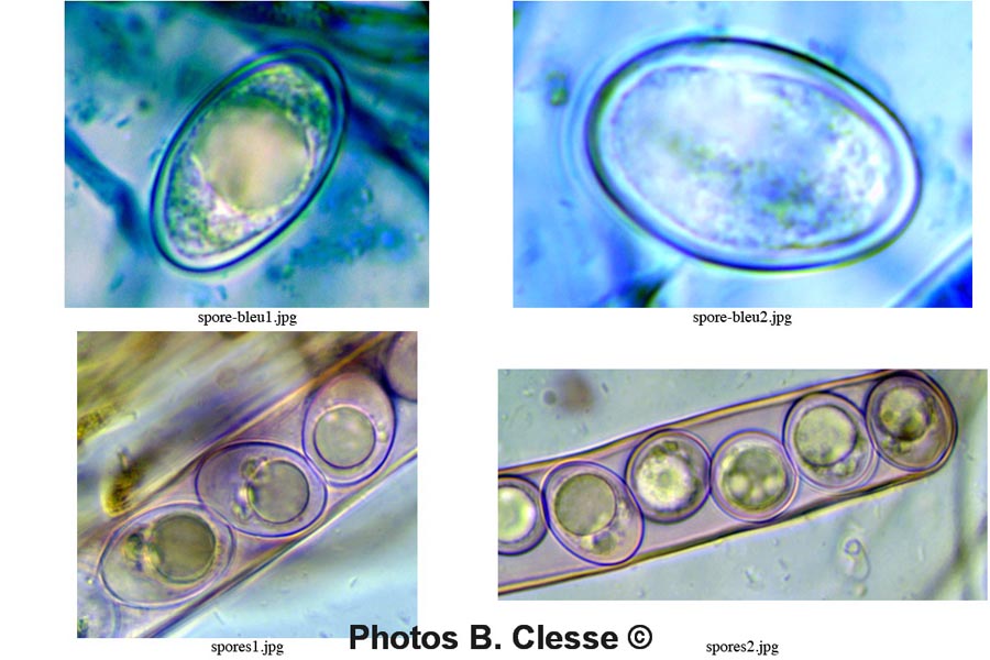 Octospora excipulata