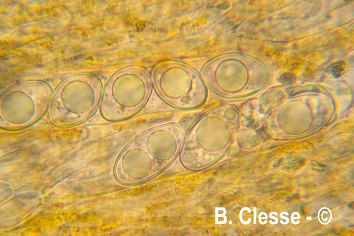 Octospora excipulata