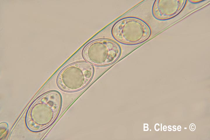 Octospora excipulata