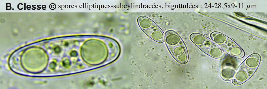 Octospora musci-muralis