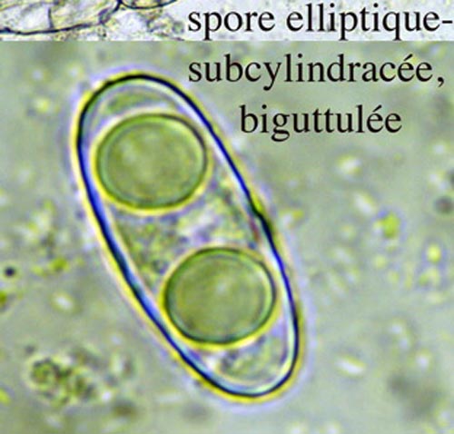 Octospora musci-muralis