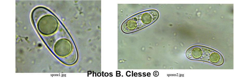 Octospora musci-muralis