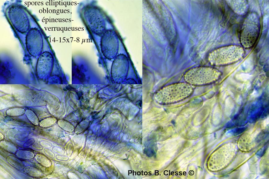 Peziza echinospora