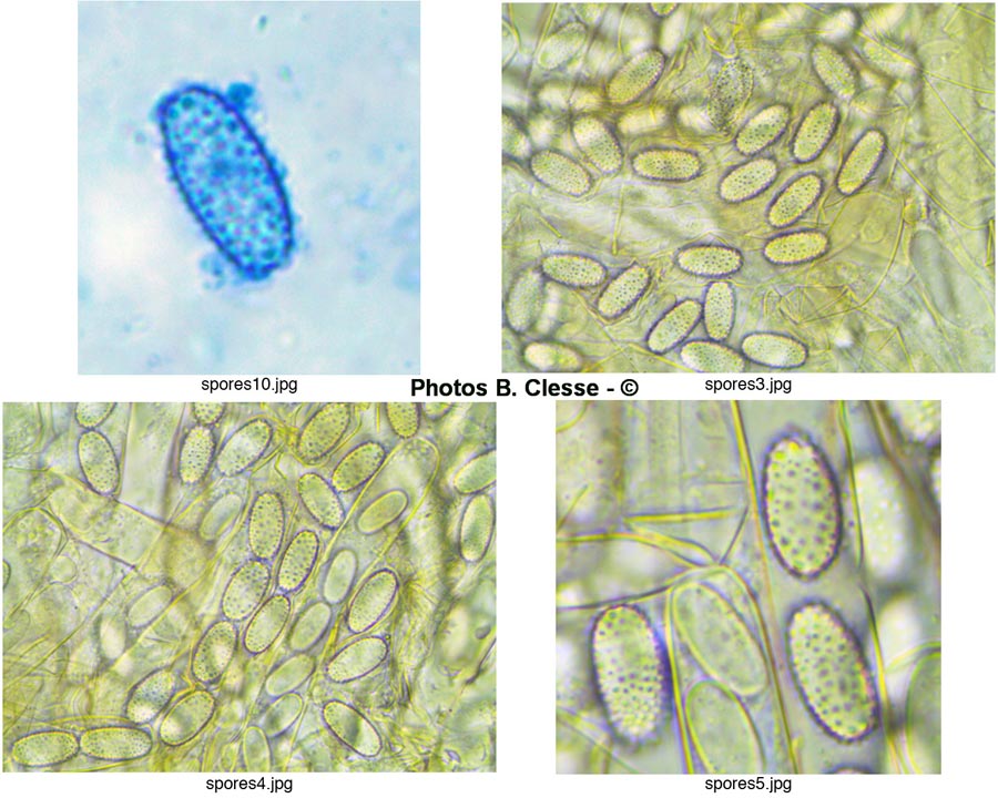 Peziza echinospora