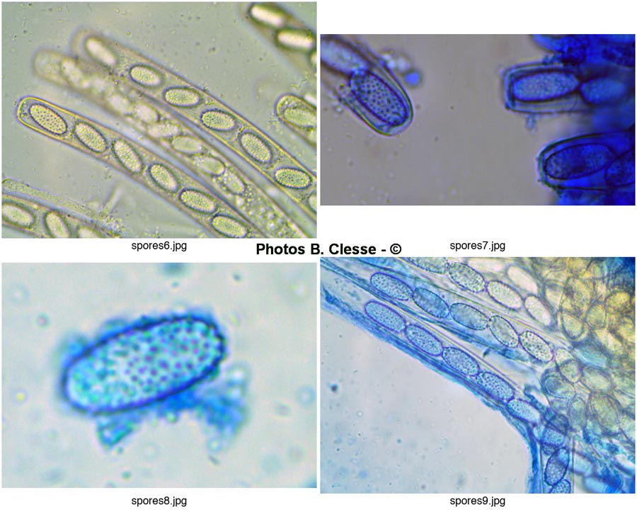 Peziza echinospora