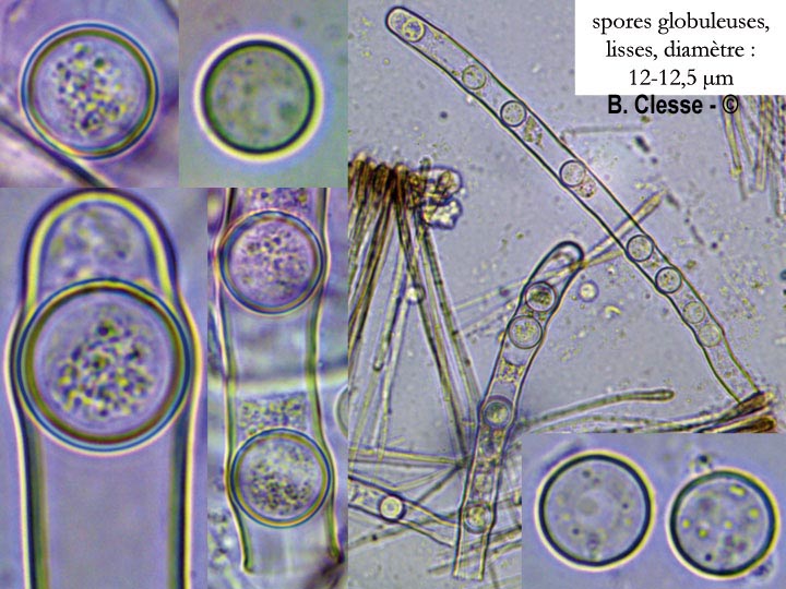 Pseudoplectania nigrella