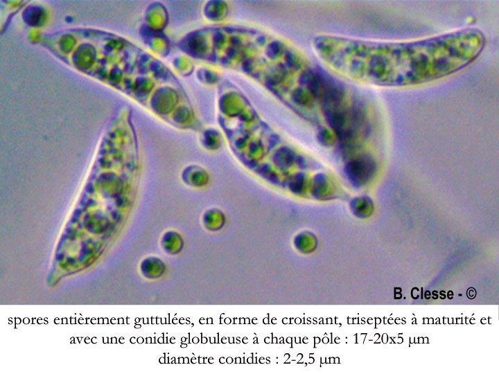 Rutstroemia firma