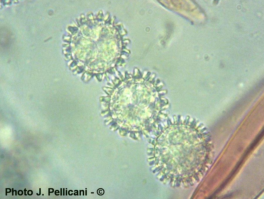 Scutillinia armatospora