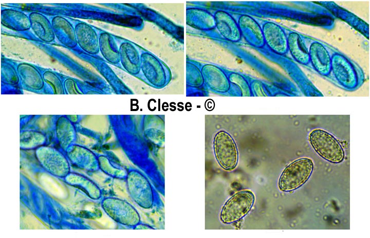 Scutellinia crucipila