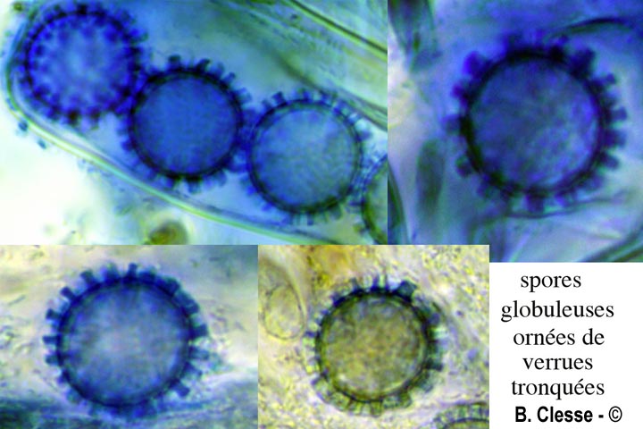 Scutellinia trechispora