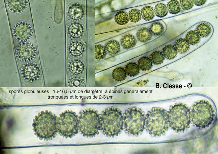 Scutellinia trechispora