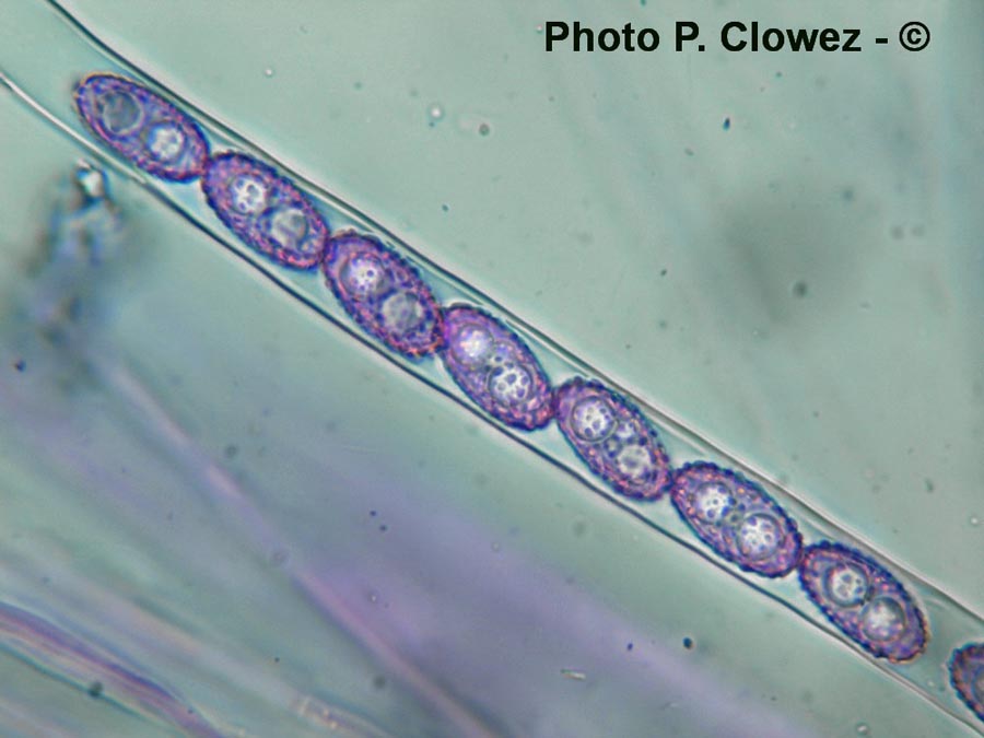 Sowerbyella polaripustulata