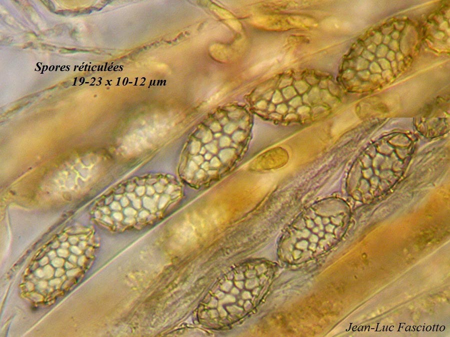 Sowerbyella rhenana