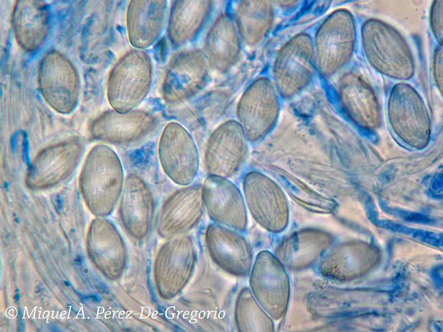 Tricharina striispora