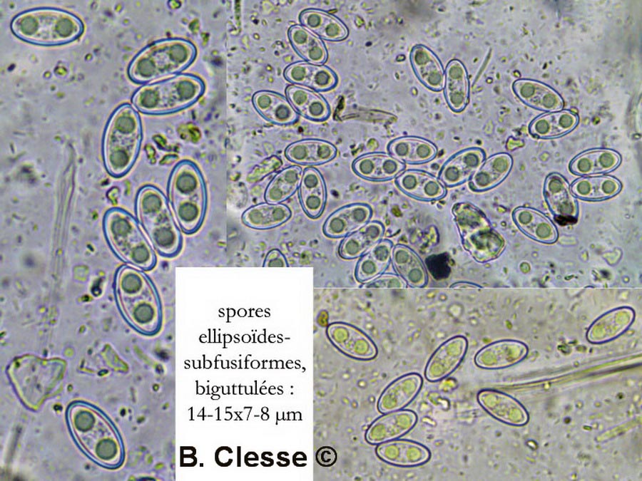 Trichophaea abundans