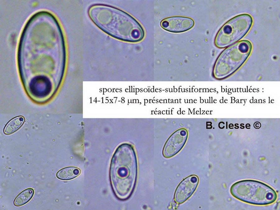 Trichophaea abundans