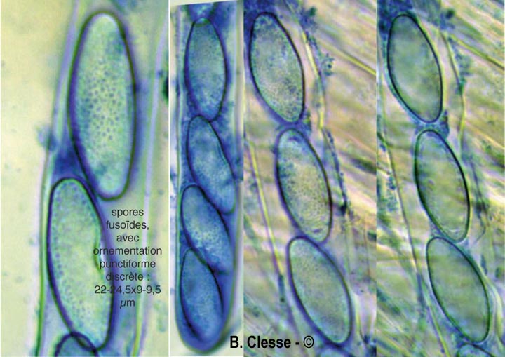 Trichophaea gregaria
