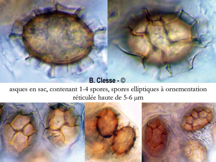 Tuber excavatum
