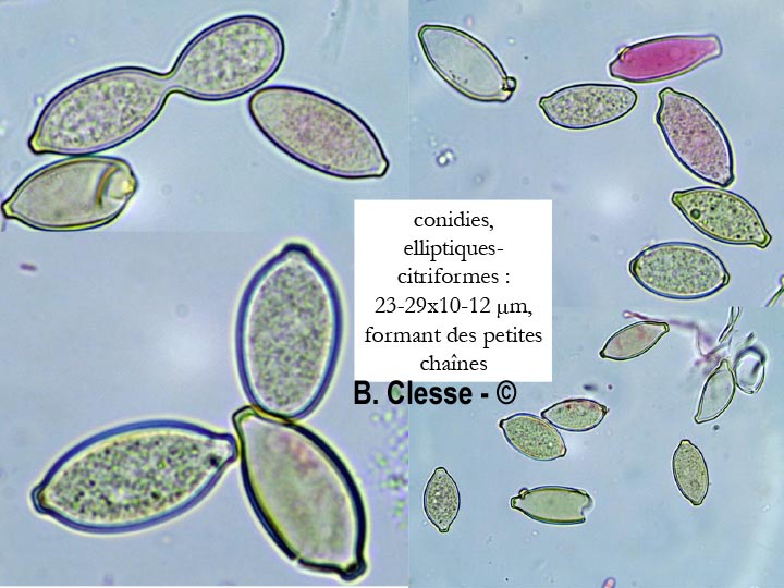 Botryobasidium aureum