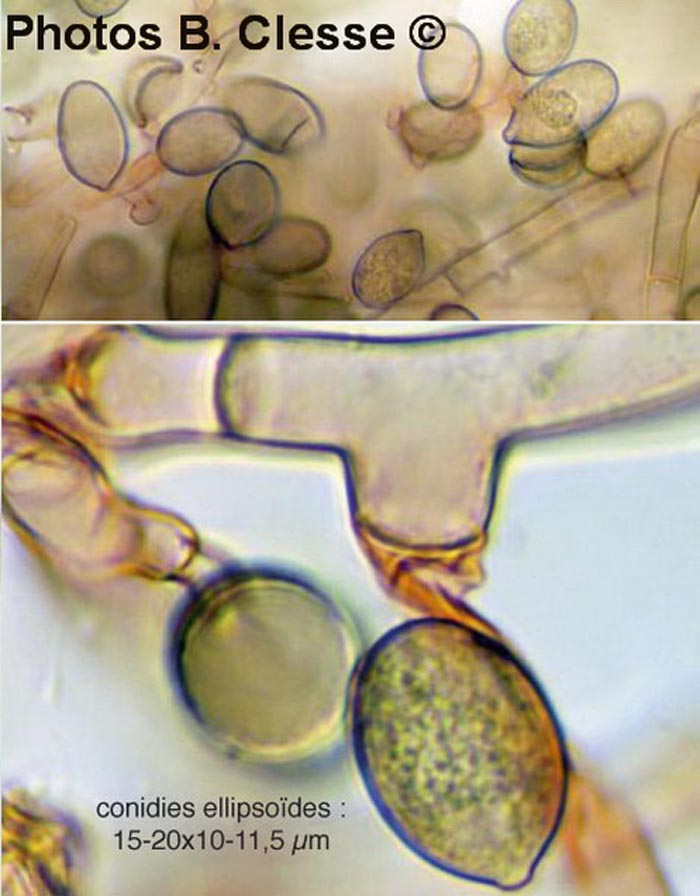 Botryobasidium conspersum