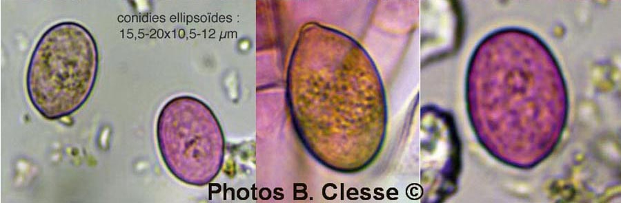 Botryobasidium conspersum