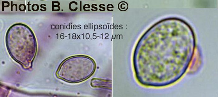 Botryobasidium conspersum