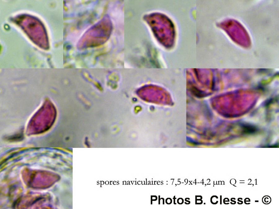 Botryobasidium ellipsosporum