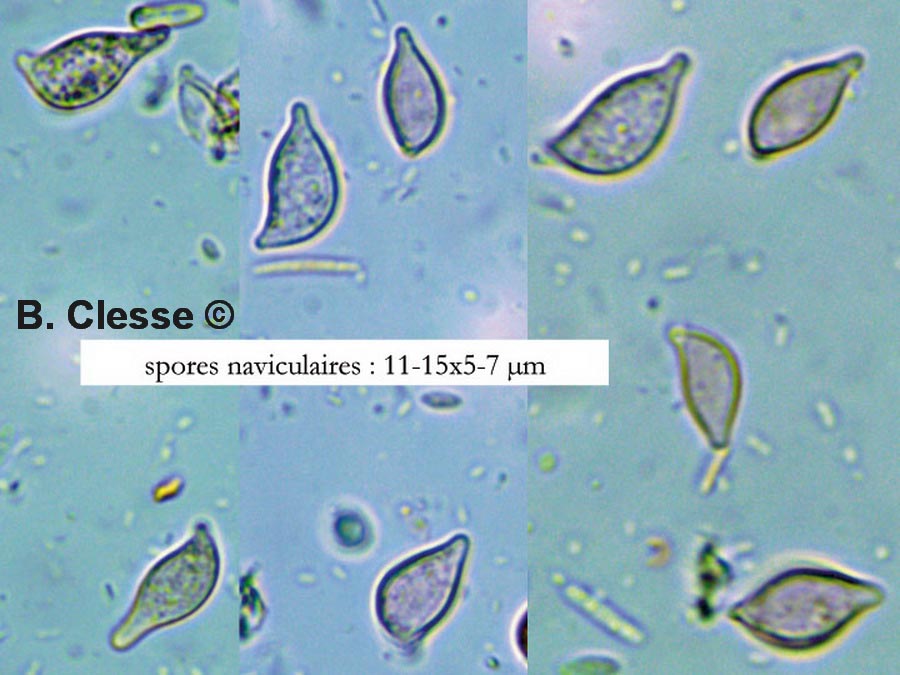 Botryobasidium medium