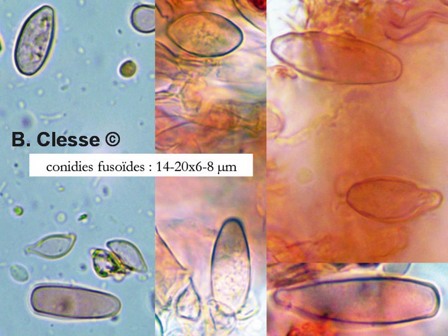 Botryobasidium medium