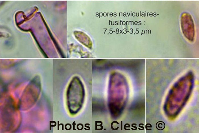 Botryobasidium subcoronatum